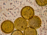 Elfen-Krokus (Crocus tommasinianus)Pollen (Mikroskopaufnahme)