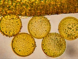 Elfen-Krokus (Crocus tommasinianus)Pollen an Staubbeutel (Mikroskopaufnahme)