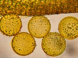 Elfen-Krokus (Crocus tommasinianus)Pollen an Staubbeutel (Mikroskopaufnahme)
