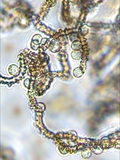 Charakteristisch für Arcyria incarnata das Capillitium und die Spore.
