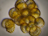 Stäublings-Schleimpilz (Enteridium lycoperdon) Sporen 7-10 µm, braun, Vergrößerung 1000x 