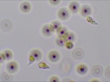 Sporen und Myxamöben von Lycogala epidendrum. Die Myxamöben sind ca. 10µm = 0,001cm klein. Hier gibt es ein kleines Video zum Thema.  