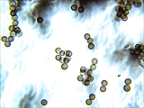 Einige Stationen des Lebens des Schleimpilzes stemonitus fusca: Sporen unter dem Mikroskop).