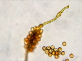 Mikroaufnahme einer Capillitium und von Sporen