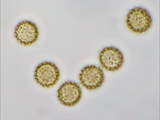 Tubulifera arachnoidea (Synonym: Tubifera ferruginosa). Sporen Mikroskopaufnahme