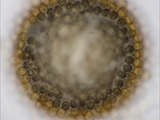 Tubulifera arachnoidea (Synonym: Tubifera ferruginosa). Sporenpaket Mikroskopaufnahme