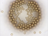 Tubulifera arachnoidea (Synonym: Tubifera ferruginosa). Sporenpaket Mikroskopaufnahme